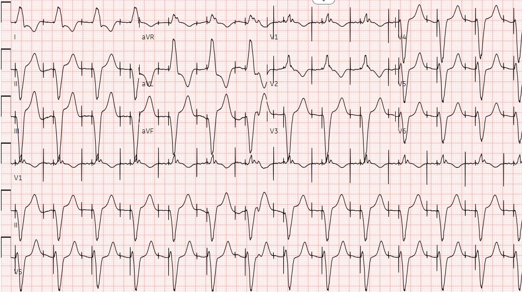 Doctor with ECG